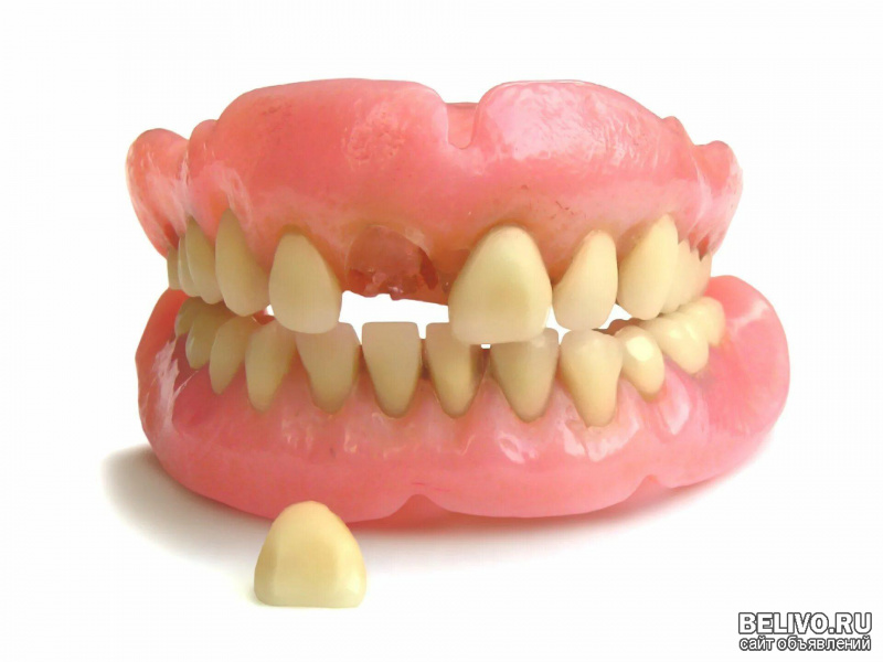 Ремонт при выпадении зуба из протеза